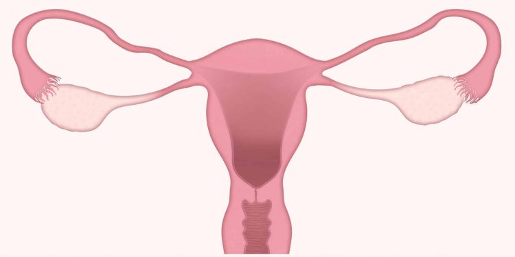 11 Causes Of Uterine Prolapse And 9 Ways To Prevent It Dd